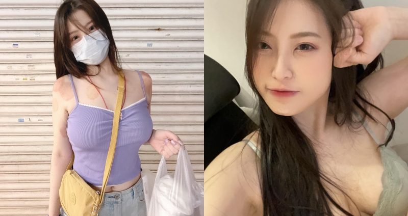 辣模 Yumi.k 傳出健康狀況掛病號，不自覺狂噴鼻血。（圖：臉書）